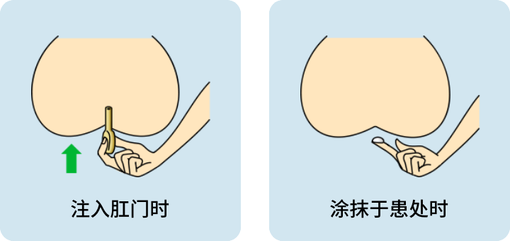 现货日本 武田药品 痔疮神药 BORRAGINOLA 痔疮膏 注入式软膏 疼痛 出血 内外痔